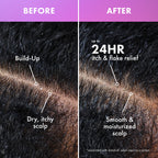 Lavender & Lychee Daily Scalp Moisturizing Lotion